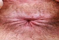 ATK hairy Dakota Marr Set