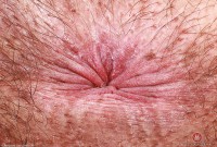 ATK hairy Dakota Marr Set