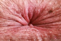 ATK hairy Dakota Marr Set