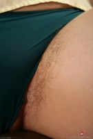 ATK hairy  in young and hairy