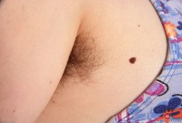 ATK hairy  in young and hairy