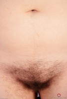 ATK hairy  in young and hairy