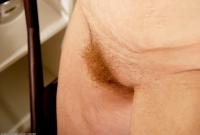 ATK hairy  in mature and hairy