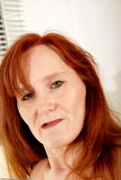 ATK hairy  in mature and hairy