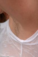 ATK hairy  in mature and hairy