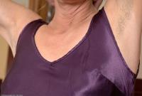 ATK hairy  in mature and hairy