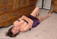 ATK hairy  in mature and hairy