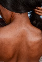 ATK hairy  in exotic and hairy