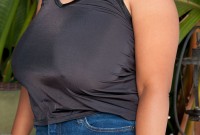 ATK hairy  in mature and hairy