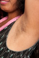 ATK hairy  in mature and hairy