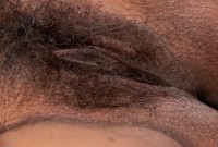 ATK hairy  in mature and hairy