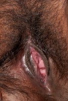 ATK hairy  in mature and hairy