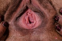 ATK hairy  in mature and hairy