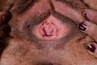 ATK hairy  in mature and hairy