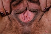 ATK hairy  in mature and hairy