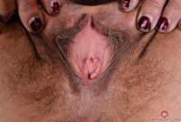ATK hairy  in mature and hairy
