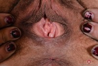 ATK hairy  in mature and hairy