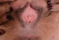 ATK hairy  in mature and hairy