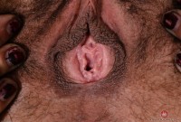 ATK hairy  in mature and hairy