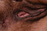 ATK hairy  in mature and hairy