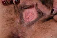ATK hairy  in mature and hairy