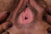 ATK hairy  in mature and hairy