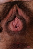 ATK hairy  in mature and hairy