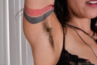 ATK hairy  in mature and hairy