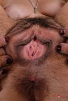 ATK hairy  in mature and hairy