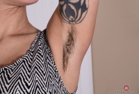ATK hairy  in mature and hairy