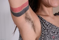 ATK hairy  in mature and hairy