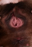 ATK hairy  in mature and hairy