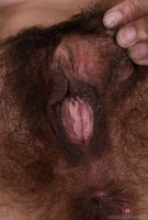 ATK hairy  in mature and hairy