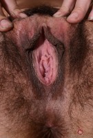 ATK hairy  in mature and hairy