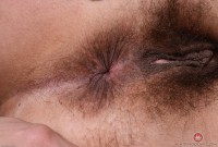 ATK hairy  in mature and hairy