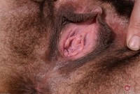 ATK hairy  in mature and hairy