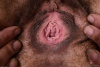 ATK hairy  in mature and hairy