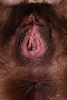 ATK hairy  in mature and hairy