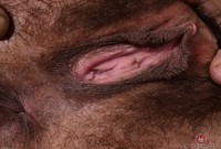 ATK hairy  in mature and hairy