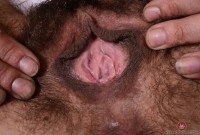 ATK hairy  in mature and hairy