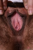 ATK hairy  in mature and hairy