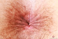 ATK hairy Delta Hauser Set