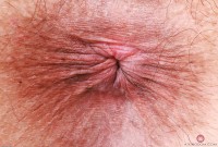 ATK hairy Delta Hauser Set