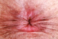 ATK hairy Delta Hauser Set