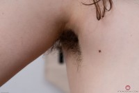ATK hairy  in mature and hairy