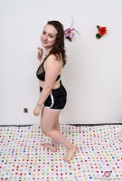 ATK hairy  in mature and hairy