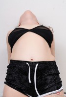 ATK hairy  in mature and hairy