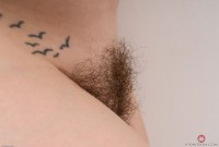 ATK hairy  in mature and hairy