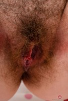 ATK hairy  in mature and hairy