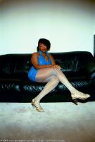 ATK hairy  in mature and hairy